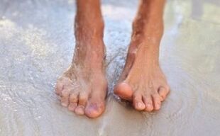 Walking barefoot is the cause of the fungus