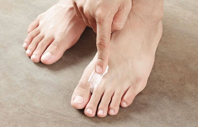 ointment for toenail fungus