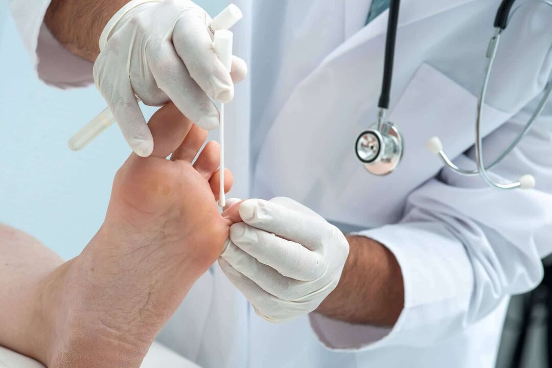 Have foot fungus checked by a doctor