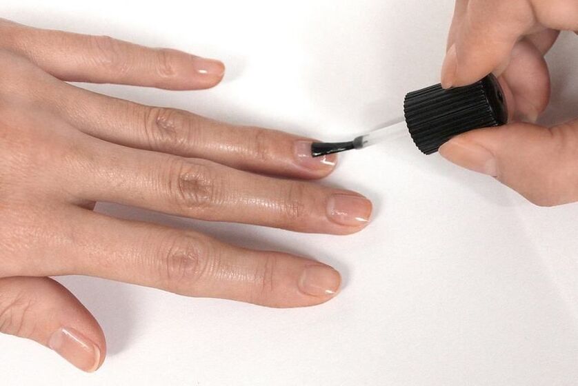 How to Choose a Polish for Nail Fungus