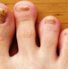 Nog's feet