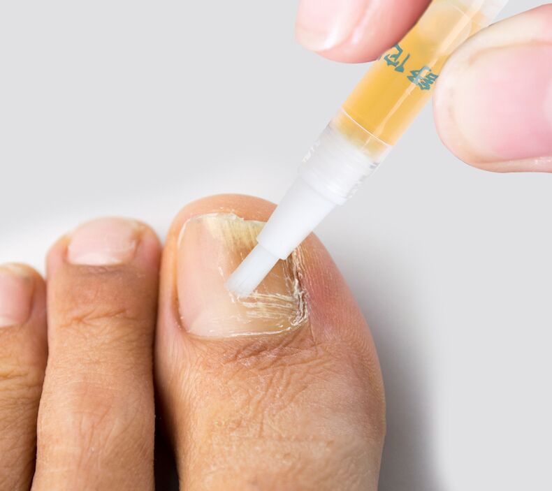 Liquid to fight toenail fungus